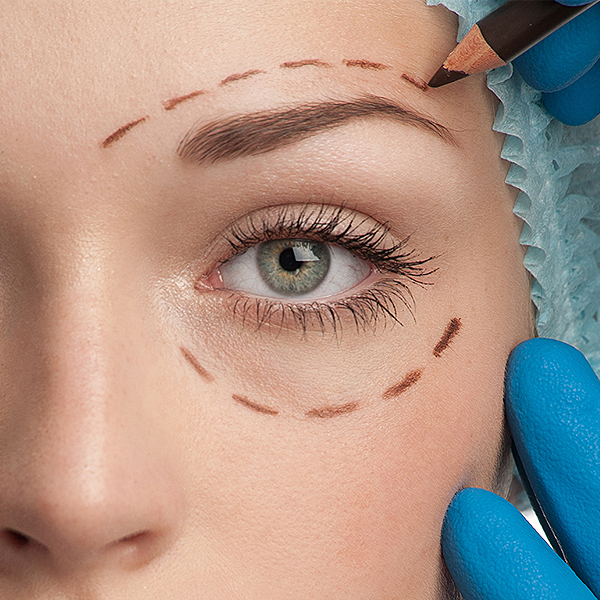 PLASTICA OCULAR